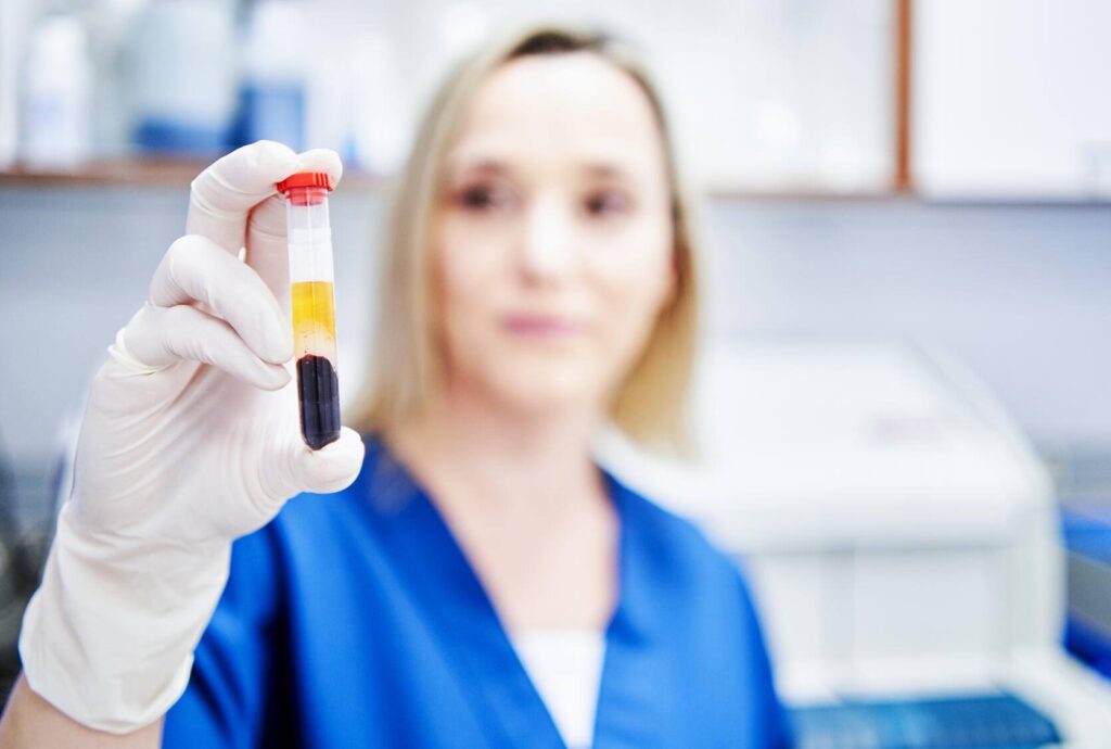 Multicancer blood test detects 17 cancer types in large prospective study